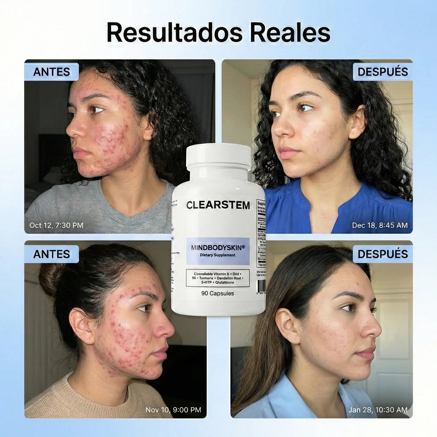Clearstem Mindbodyskin - Tratamiento para Acné Hormonal