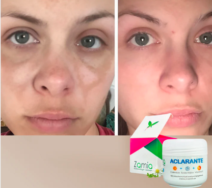Crema Aclarante Zamia ✨ Despídete de las manchas