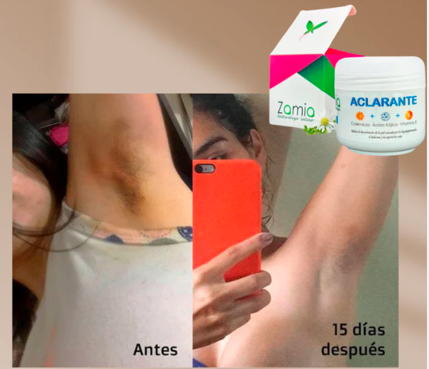 Crema Aclarante Zamia ✨ Despídete de las manchas