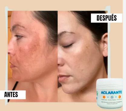 Crema Aclarante Zamia ✨ Despídete de las manchas
