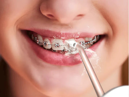 Irrigador Dental - Limpieza profunda que se ve y se siente