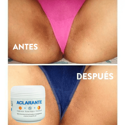 Crema Aclarante Zamia ✨ Despídete de las manchas