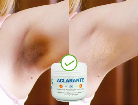 Crema Aclarante Zamia ✨ Despídete de las manchas